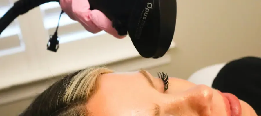 Patient getting Opus RF treatment.