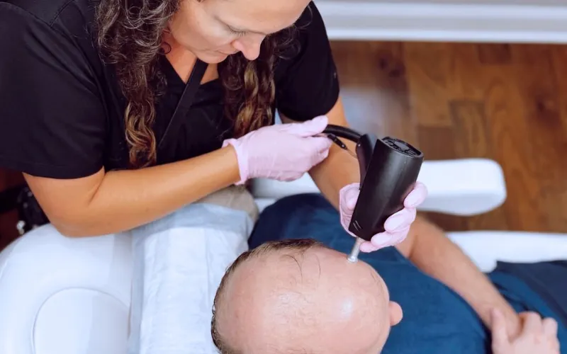 TED hair restoration treatment on a client.